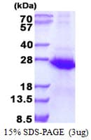 Human ECSIT Protein (Recombinant His)