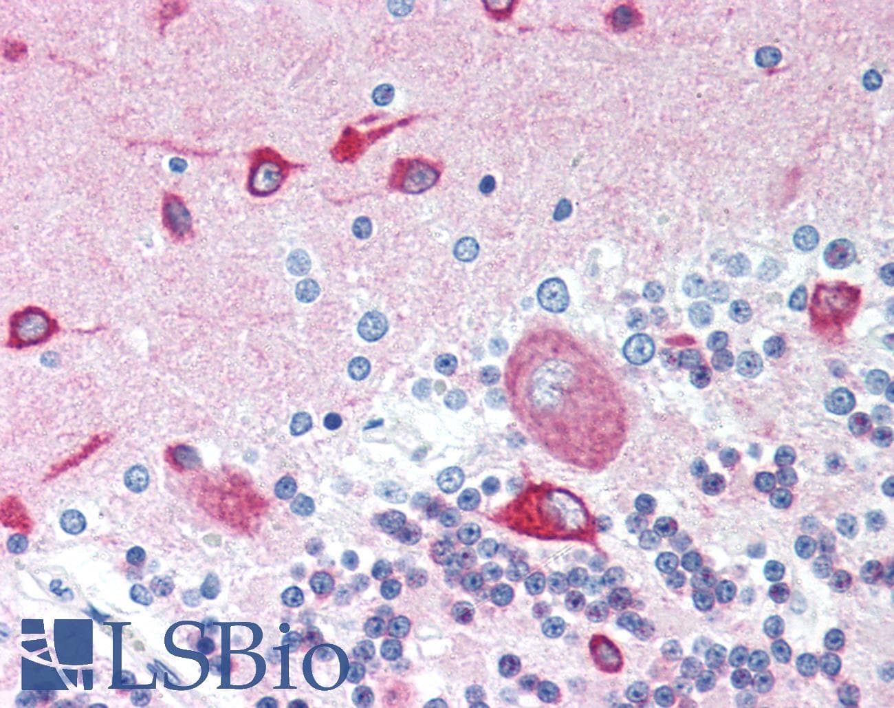 IHC-plus™ Tuberin / TSC2 Antibody