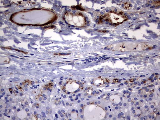 Monoclonal Mouse anti-Human CD63 Antibody (clone OTI2G6, IHC, WB)