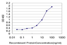 HNE / Neutrophil Elastase Antibody (clone 1A11)