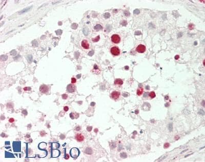 IHC-plus™ Polyclonal Rabbit anti-Human TBPL2 / TRF3 Antibody (aa81-130, IHC, WB)