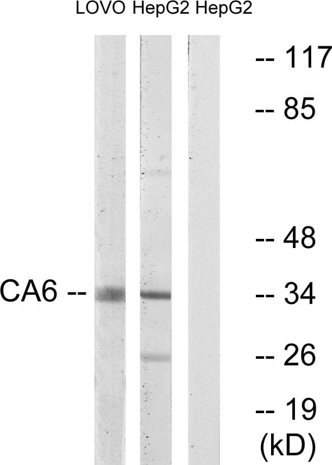 Polyclonal Rabbit anti-Human CA6 / Carbonic Anhydrase 6 Antibody (WB)