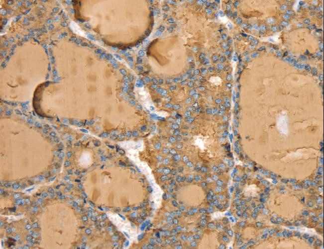Polyclonal Rabbit anti-Human TG / Thyroglobulin Antibody (IHC)