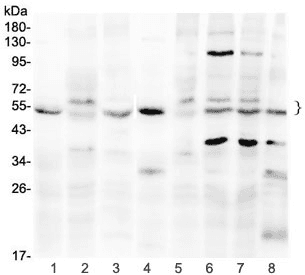 Polyclonal Rabbit anti-Human SMAD1 Antibody (WB)