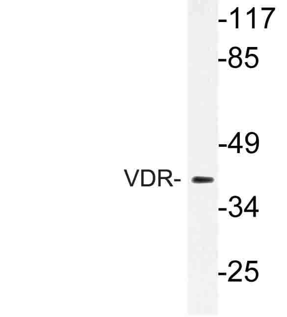Vitamin D Receptor / VDR Antibody (Lys45)