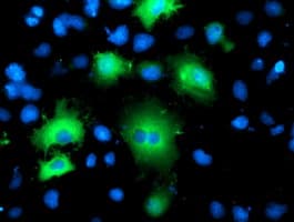 BAIAP2 / IRSP53 Antibody (clone OTI1F4)