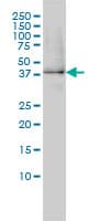 IHC-plus™ Monoclonal Mouse anti-Human GPN1 / XAB1 Antibody (clone 3E1, IHC, IF, WB)