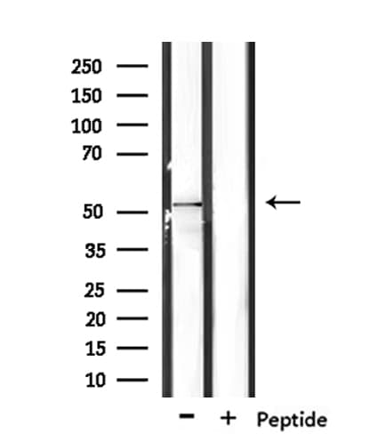 RASGEF1C Antibody