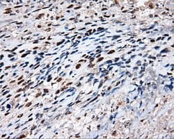 Monoclonal Mouse anti-Human TLDC1 / KIAA1609 Antibody (clone OTI5D9, IHC, IF, WB)