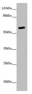 Polyclonal Rabbit anti-Human PRMT3 Antibody (IHC, IF, WB)