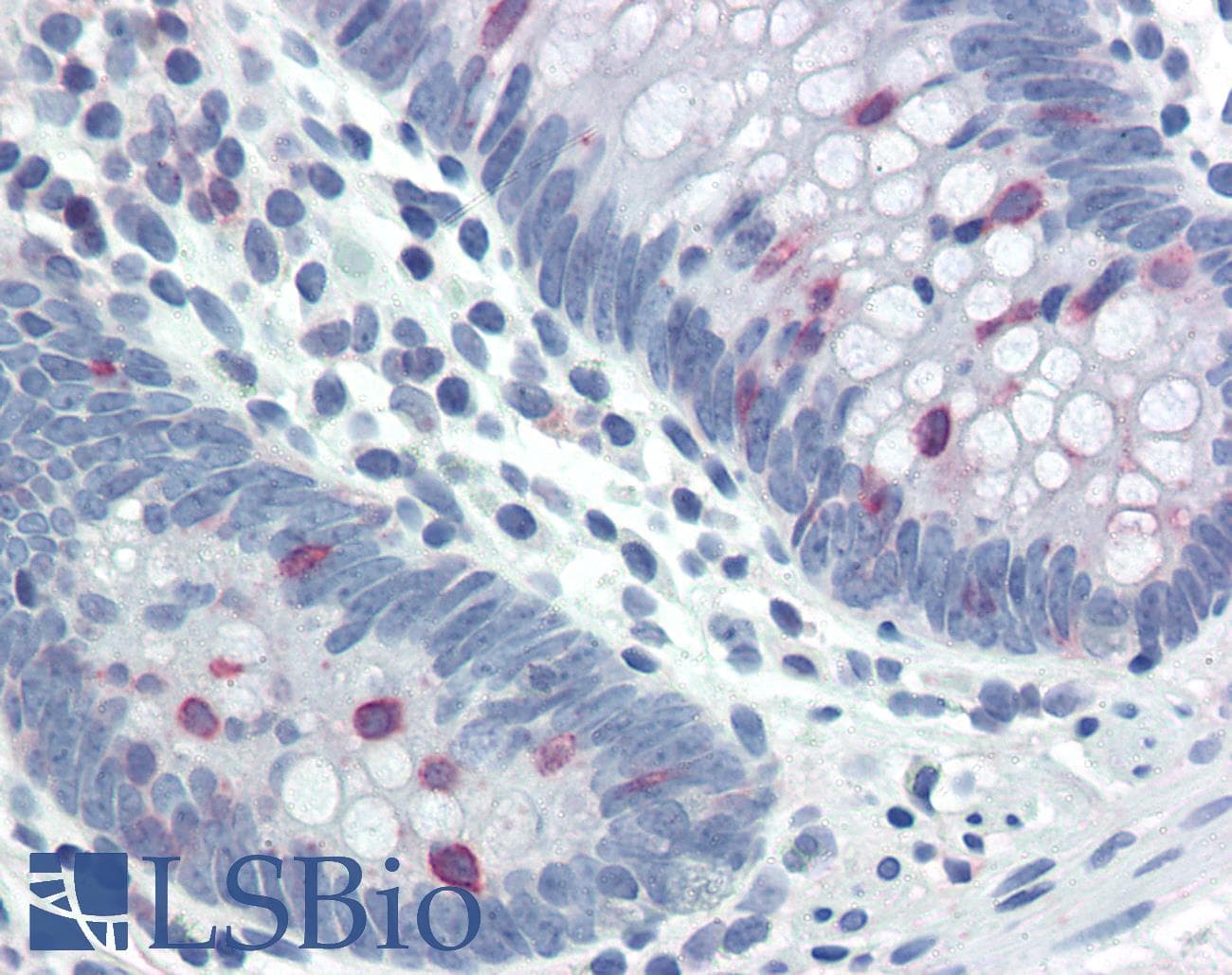 IHC-plus™ STAT5 A+B Antibody (phospho-Tyr694)