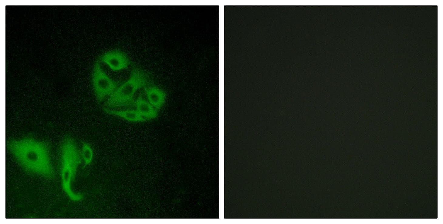 Polyclonal Rabbit anti-Human GPR20 Antibody (IHC, IF, WB)