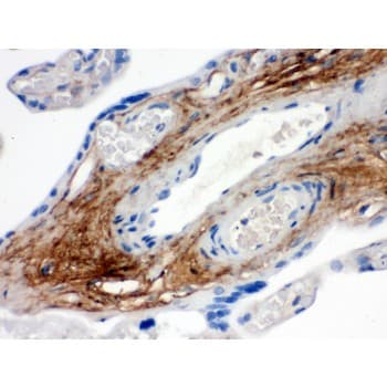 TNXB / Tenascin XB Antibody (aa3309-3337)