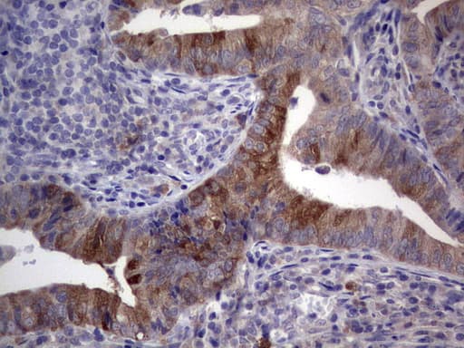 R1 / RRM1 Antibody (aa541-792, clone OTI2D10)