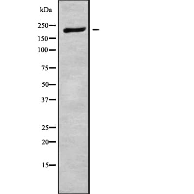 Polyclonal Rabbit anti-Human PLXNA2 / Plexin A2 Antibody (IHC, WB)