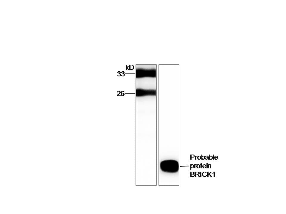 IHC-plus™ C3orf10 Antibody