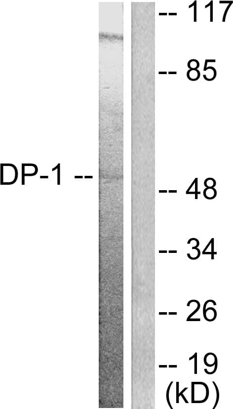 Polyclonal Rabbit anti-Human TFDP1 Antibody (aa361-410, IHC, IF, WB)