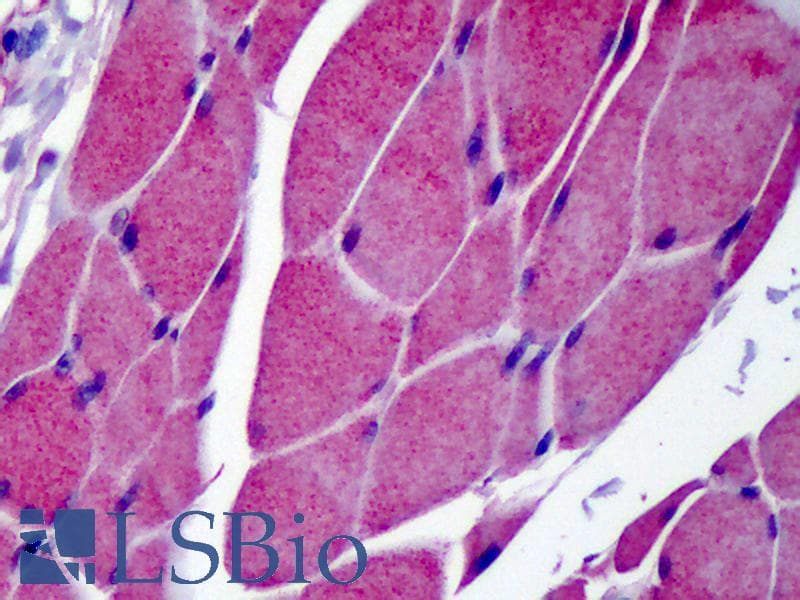 TRPC3 Antibody