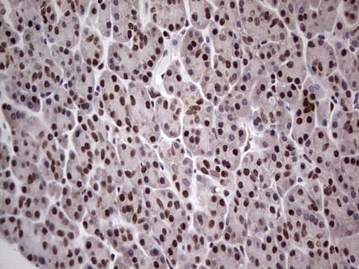 PPP1R8 / Rnase E Antibody (aa1-225, clone OTI4D5)