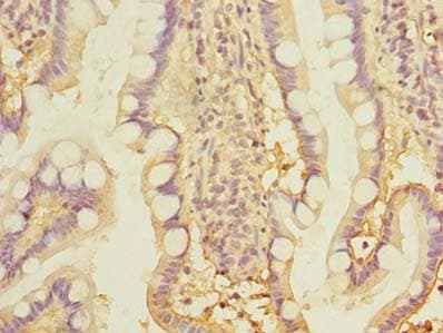 THTPA Antibody