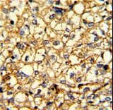 ADRA2B Antibody (aa343-369)