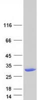 Human DHRS11 / MGC4172 Protein (Recombinant Myc-DDK (Flag))