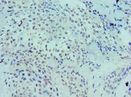 LRP6 Antibody (aa20-150)