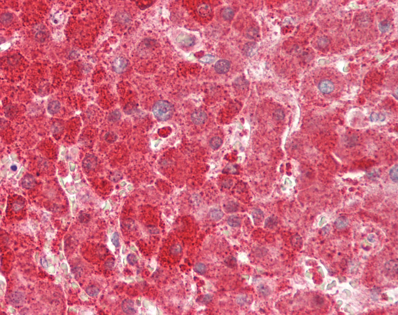 Polyclonal Rabbit anti-Human KHK / Ketohexokinase Antibody (aa201-250, IHC, WB)