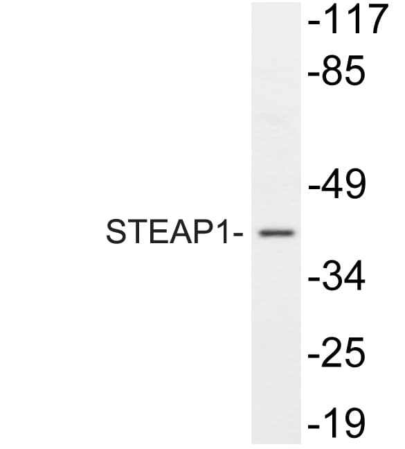 Polyclonal Rabbit anti-Human STEAP1 / STEAP Antibody (Asp31, IHC, WB)