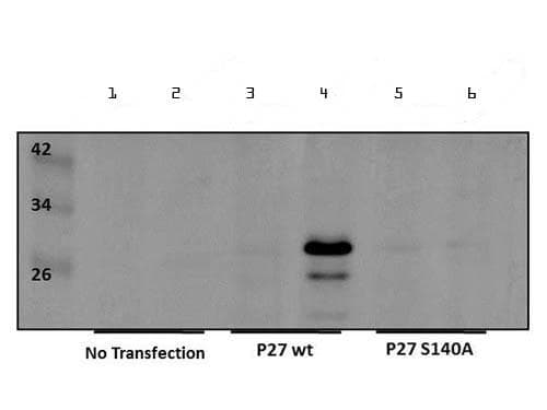 CDKN1B / p27 Kip1 Antibody (phospho-Ser140)