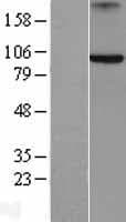 Human AXIN2 / Axin 2 Protein (Over-Expression Lysate Myc-DDK (Flag))