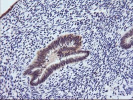 PIK3R5 Antibody (clone OTI2A6)