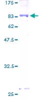 Human DPYSL5 / CRMP5 Protein (Recombinant GST)