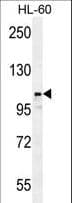 LNPEP Antibody (aa23-52)