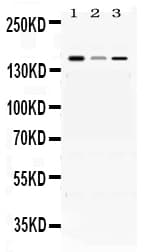 ADAMTS13 Antibody
