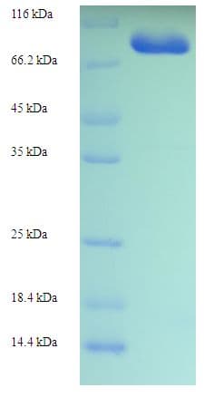 Human MYO19 / Myosin XIX Protein (Recombinant His-SUMO)