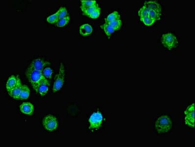 TRIM1 / MID2 Antibody