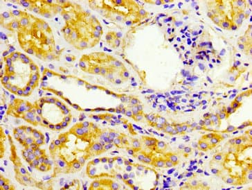 Polyclonal Rabbit anti-Human EPSTI1 Antibody (IHC, WB)