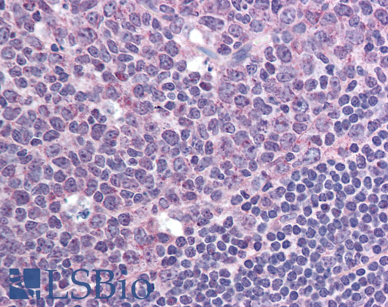 IHC-plus™ ACKR3 / CXCR7 Antibody (aa100-150)