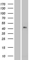 TM6SF2 Protein (Over-Expression Lysate Myc-DDK (Flag))