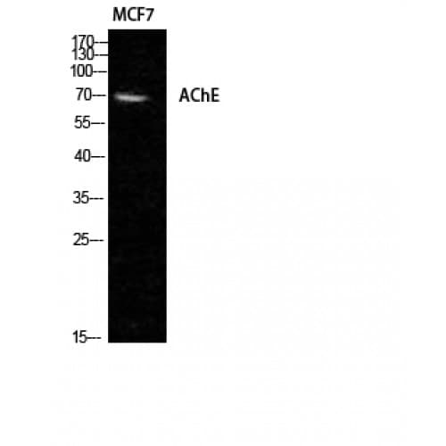 ACHE / Acetylcholinesterase Antibody (Internal)