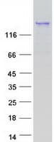 Human PROB1 Protein (Recombinant Myc-DDK (Flag))