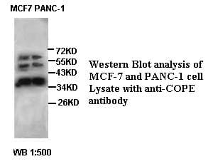 Polyclonal Rabbit anti-Human COPE Antibody (IHC, WB)