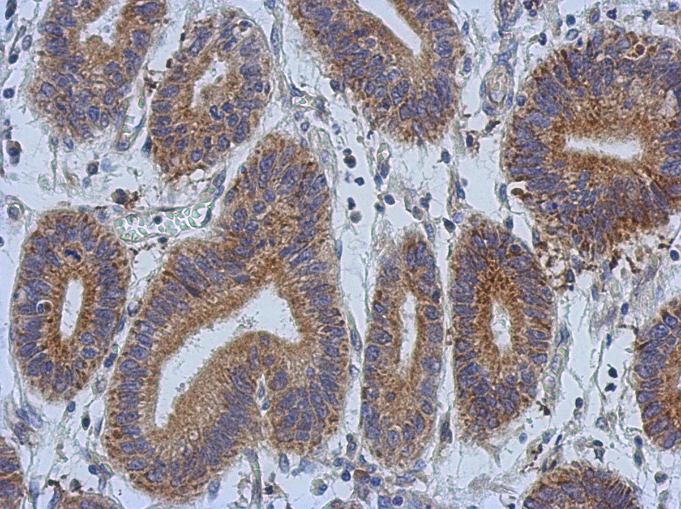 Polyclonal Rabbit anti-Human DCBLD2 Antibody (IHC, WB)