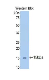 IL13RA2 / IL13R Alpha 2 Antibody (aa238-334)