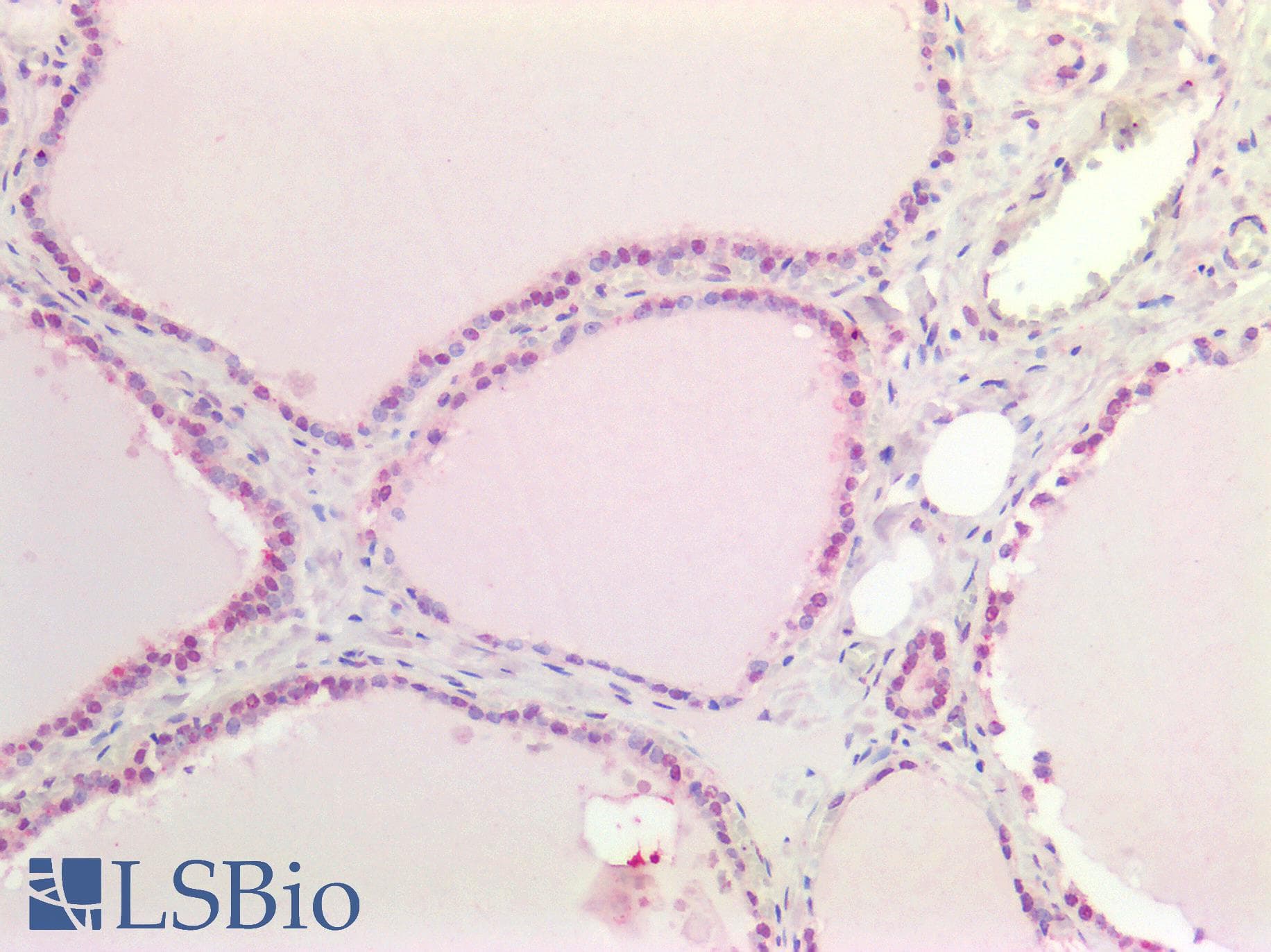 PathPlus™ Polyclonal Rabbit anti-Human MYC / c-Myc Antibody (IHC)