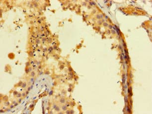 SAMSN1 Antibody