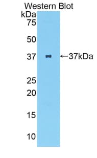 PTH / Parathyroid Hormone Antibody (aa32-115, Biotin)