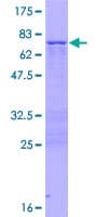 Human ZNF385A / ZNF385 Protein (Recombinant GST)