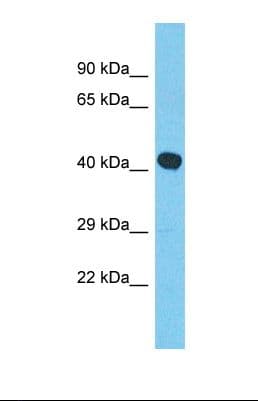 MYLK4 Antibody (C-Terminus)